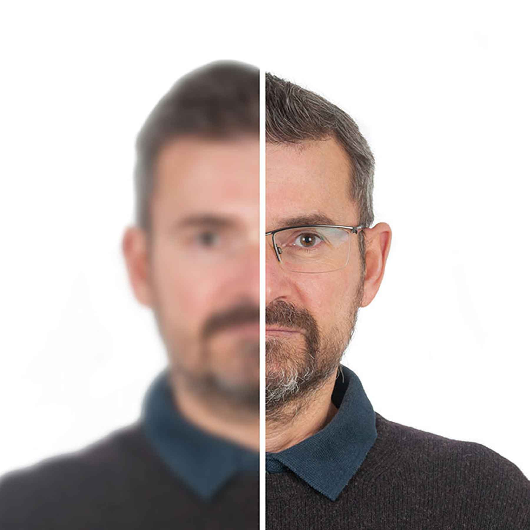 blur-guy Man with one side of his face in sharp focus and the other side blurred, demonstrating vision impairment.
