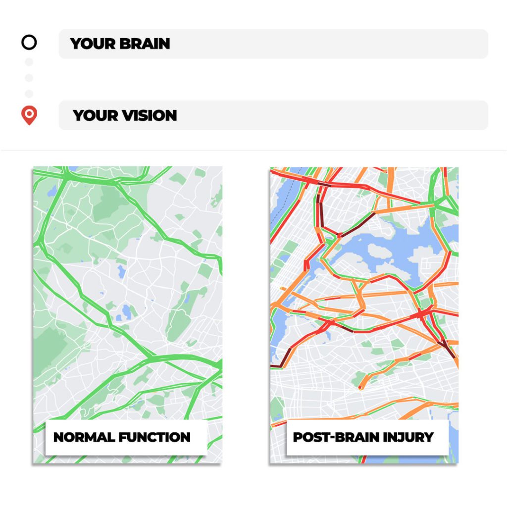 Comparison graphic showing maps with labeled 'Normal Function' and 'Post-Brain Injury,' with the normal map displaying clear green routes and the post-brain injury map showing congestion in red and orange lines.