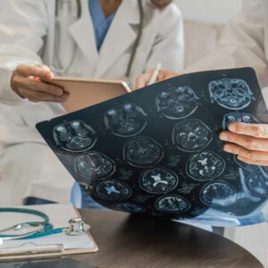 Doctors reviewing a brain scan displayed on a lightbox.