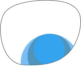 Free-form round. Used for special lens designs that would otherwise be unavailable. Can be placed anywhere on the lens to make golfer segs.