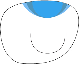 Chadwick's Standard Flat-top with free-form round add (any size)