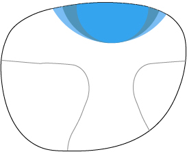 Chadwick's Standard Progressive with free-form round add (any size)